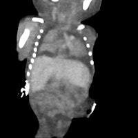 coronal image