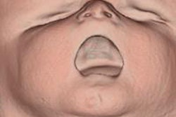 2014 10 15 09 20 38 581 2014 10 15 Fetal Autopsy Se000 20141015162126