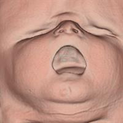 2014 10 15 09 20 38 581 2014 10 15 Fetal Autopsy Se000 20141015162126