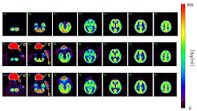 2014 10 16 11 40 47 551 2014 10 17 Medphysweb Pet O15 Fig2 350