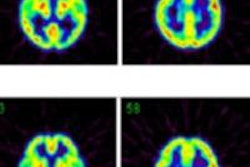 2014 10 16 11 40 55 191 2014 10 17 Medphysweb Pet O15 Fig2 20141016190057