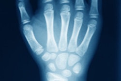 2014 10 22 13 29 49 951 Wrist X Ray 200