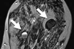 2014 11 04 17 43 32 779 2014 11 05 Breast Mri Figure 1 800 20141105004753