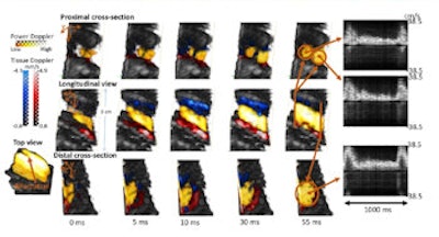 2014 11 10 12 50 39 16 2014 11 11 Medphysweb Pmb Ultrafast Us 350