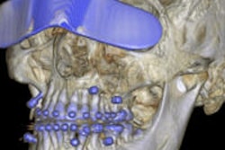 2014 11 14 13 21 41 398 2014 11 17 Head And Neck Thumb