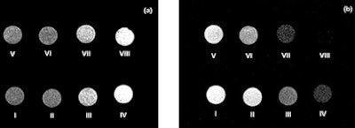T1- (a) and T2-weighted (b) MR images for: (I) degassed water; (II) SPIOs with 0.01688 mM iron concentration; (III) SPIOs with 0.0985 mM iron concentration; (IV) SPIOs with 0.252 mM iron concentration; (V) SPIO-MBs with no iron; (VI) SPIO-MBs with 0.01688 mM iron concentration; (VII) SPIO-MBs with 0.0985 mM iron concentration and (VIII) SPIO-MBs with 0.252 mM iron concentration.