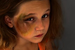 2014 11 21 09 27 03 622 Abused Girl 200