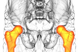 2014 12 01 14 55 29 575 Femur And Pelvis 200