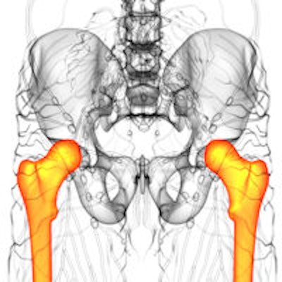 2014 12 01 14 55 29 575 Femur And Pelvis 200