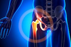 2014 12 04 10 29 26 325 Hip 200