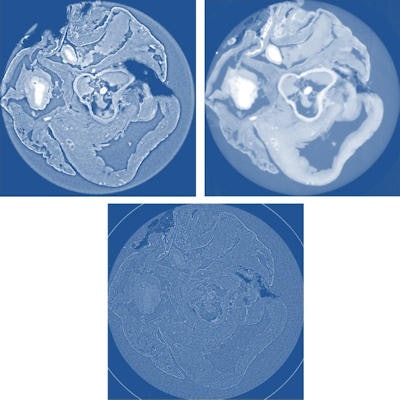 Top left: X-ray phase tomography slice of a rat's heart using propagation-based XPCi. Top right: X-ray phase tomography slice of a rat's heart using grating-based XPCi; the image has high contrast, but with some blurring compared to propagation-based XPCi. Bottom: conventional absorption-based x-ray CT with significantly lower contrast than phase-contrast scans.