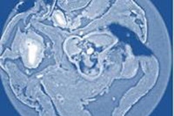 2014 12 11 13 29 14 936 2014 12 12 Medphysweb Zanette 20141211203249