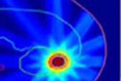 2014 12 24 10 34 50 493 2014 12 26 Medphysweb 4 D Kidney Imrt 20141224174903