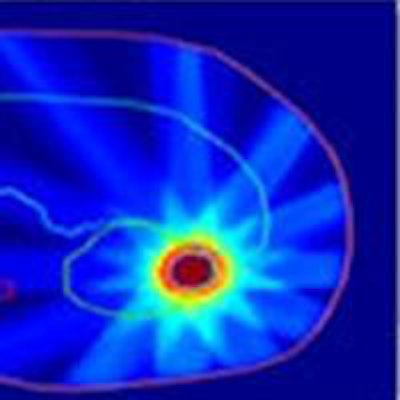 2014 12 24 10 34 50 493 2014 12 26 Medphysweb 4 D Kidney Imrt 20141224174903