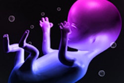 2015 01 12 13 00 01 985 Fetus 200