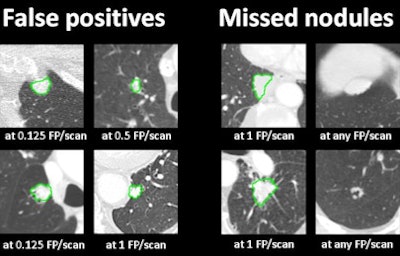 false positives and missed lesions