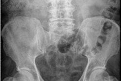 2015 01 16 13 40 28 487 Abdo X Ray