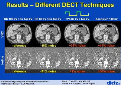 Techniques performed within DSCT had important effects on noise, including rapid voltage switching (TVS) and sandwich detectors.