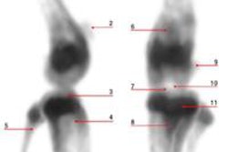 2015 01 29 13 13 15 593 2014 01 30 Medphysweb Mouse Knee Spect Ct 20150129201553