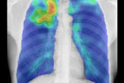 2015 01 29 12 53 32 294 2015 02 Philipsen Heatmap 200 Thumb