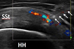 2015 02 04 18 09 25 142 Prp1 200