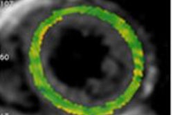 2015 02 13 12 24 53 297 2015 02 17 T2 Mapping Baessler Mri T2images 800 20150213192617