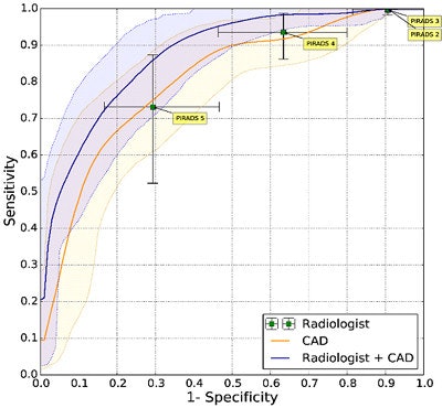 Prostate CAD scheme shows high detection rate, and results can be improved when CAD is used as a second reader. In 130 prostate cancer patients, CAD and radiologists were shown to have similar sensitivity. Simulating the addition of CAD improved sensitivity from 0.78 to 0.87 (indolent versus aggressive tumors). It improved sensitivity from 93% to 98% at PI-RADS 4.