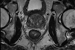 2015 02 17 12 14 24 990 2015 02 17 Prostate Cad Huisman Cad Validation Bottom 20150217191442