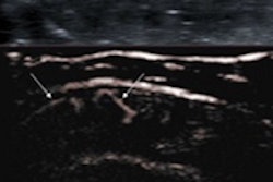 2015 02 17 12 31 03 158 Lim Smi Ultrasound 200