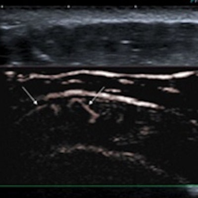 2015 02 17 12 31 03 158 Lim Smi Ultrasound 200