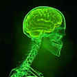 2015 02 23 09 22 30 283 Brain X Ray 200