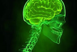 2015 02 23 09 22 30 283 Brain X Ray 200