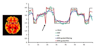 2015 02 26 12 51 03 45 2015 02 27 Medphysweb Pet Correct Fig6 700