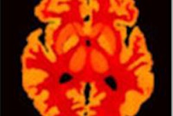 2015 02 26 12 51 04 198 2015 02 27 Medphysweb Pet Correct Fig4 20150226195228