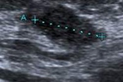 2015 03 02 17 10 53 200 2015 03 04 Breast Us2 20150303001318