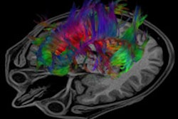 2015 03 04 20 44 05 331 2015 03 05 Brain Mri Thumb
