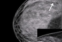 2015 03 04 21 39 19 179 2015 03 05 Breast Screening Thumb