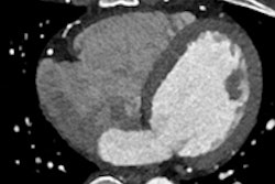 2015 03 07 15 05 01 193 2015 03 08 Imr Thumb