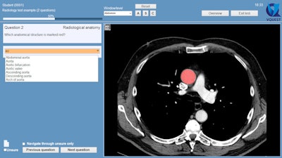 2015 03 20 10 58 16 514 2015 03 23 3 D Ravesloot Image2a 800