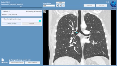 2015 03 20 10 58 17 811 2015 03 23 3 D Ravesloot Image1 800