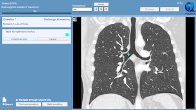 2015 03 20 10 58 17 895 2015 03 23 3 D Ravesloot Image1 350