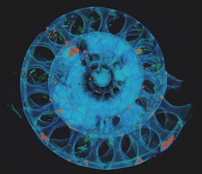 Using high-res x-ray radiation, RUB paleontologists create images of fossil ammonites. © RUBIN, image: René Hoffmann.