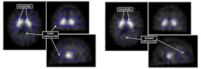 2015 04 16 10 55 33 267 2015 04 17 Medphyweb Spet Jne Fig1 350