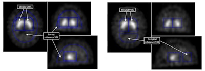 2015 04 16 10 55 34 242 2015 04 17 Medphyweb Spet Jne Fig1