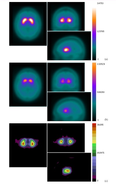2015 04 16 10 55 35 11 2015 04 17 Medphysweb Spect Jne Fig2
