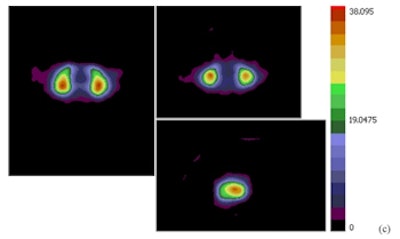 2015 04 16 11 11 11 469 2015 04 17 Medphysweb Spect Jne Fig2 350