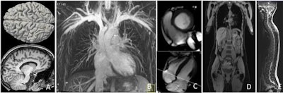 2015 05 07 11 23 50 133 2015 05 08 Nako Figure Drg 619