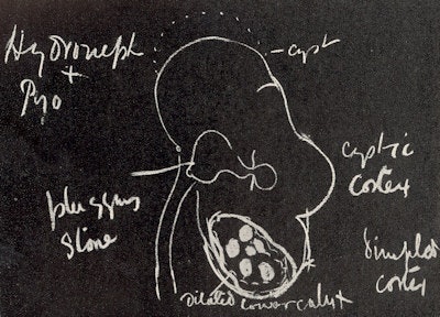 Figure 2, above: Blackboard diagram of radiographic findings. Figure 3 (below): Cystoscopic phantom from the electro-medical instruments document of K Schall (1899).