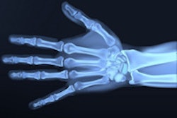 2015 05 18 12 15 06 122 Hand X Ray 200