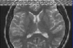 2015 06 01 12 44 02 823 2015 06 01 Mri Insider Zipper Artifact 20150602161527
